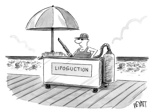 Liposuction.