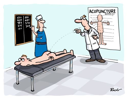 Acupuncture darts.