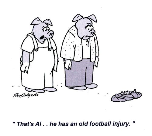 'That's Al.. he has an old football injury.'