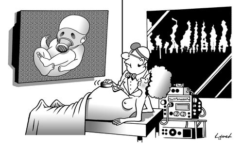 The Ultrasound.
