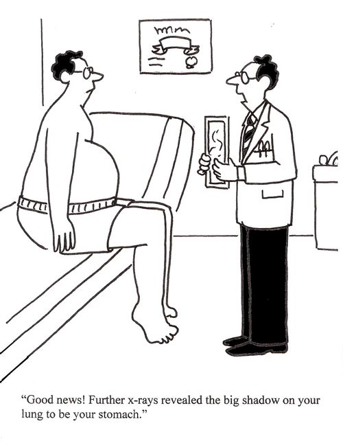 'Good News. Further x-rays revealed the big shadow on your lung to your stomach.'