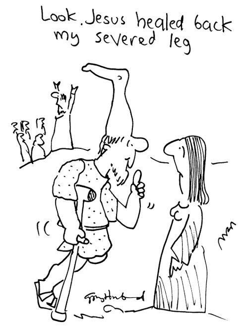 "Look. Jesus healed my severed leg."