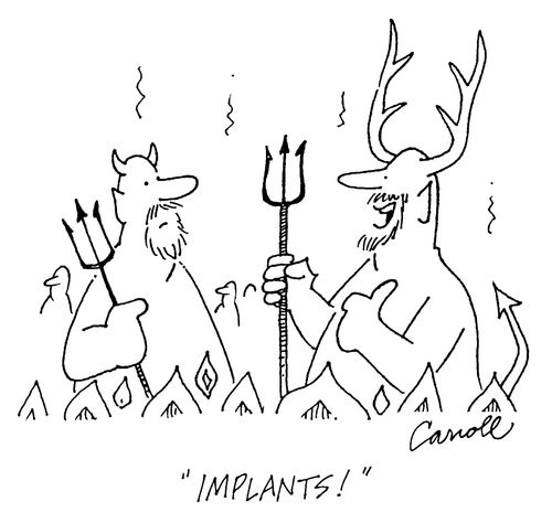 "Implants"