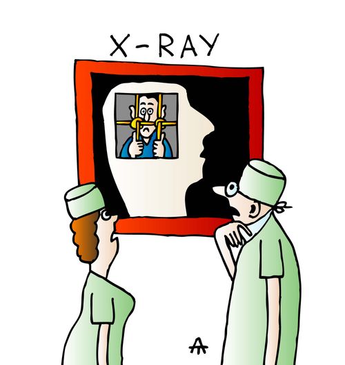 An x-ray reveals a man imprisoned in the mind of another man.