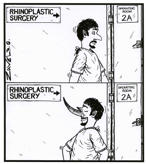 Rhinoplastic Surgery.