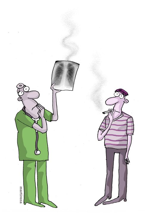Smoker has smoking x ray.