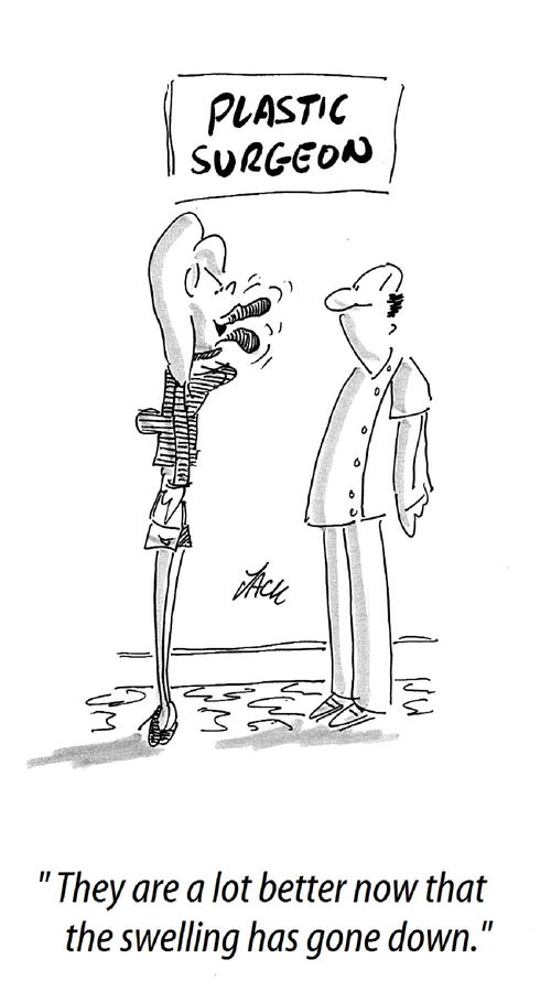 'They are a lot better now that the swelling has gone down.'