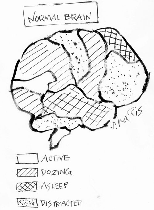 Normal brain - active, dozing, asleep, distracted