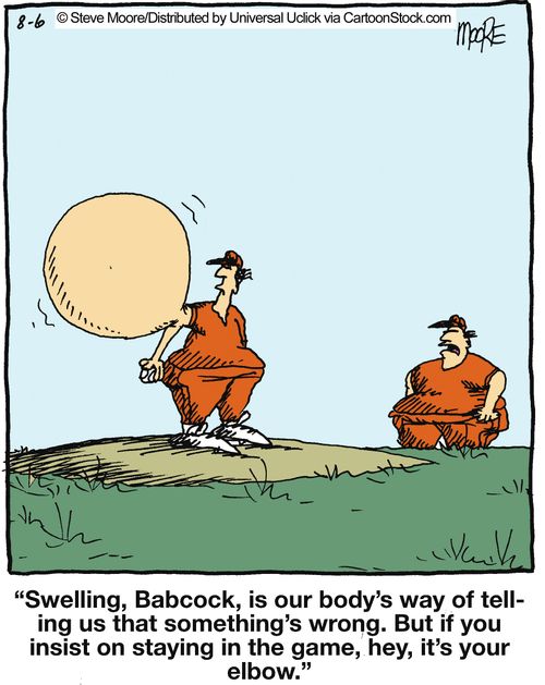 'Swelling, Babcock, is our body's way of telling us that something's wrong. But if you insist on staying in the game, hey, it's your elbow.'