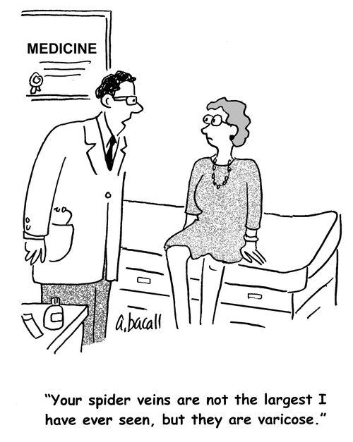 'Your spider veins are not the largest I have ever seen, but they are varicose.'