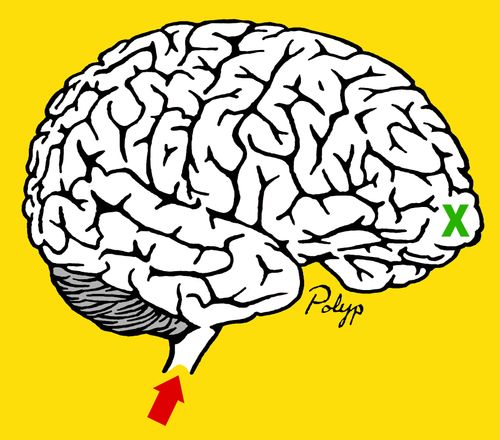 Brain maze