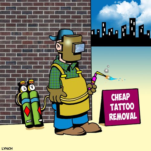 Cheap tattoo removal.