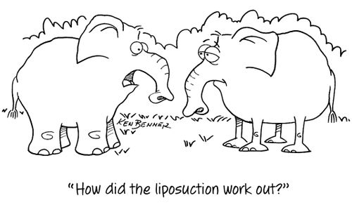 "How did the liposuction work out?"