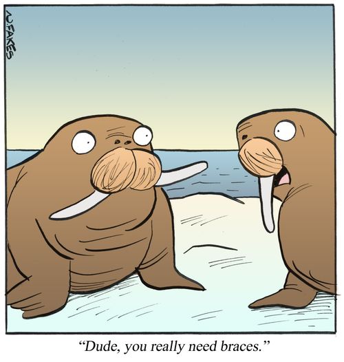 'Dude, you really need braces.'
