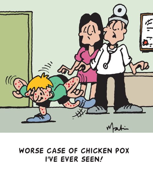 Worse case of chicken pox I've ever seen!