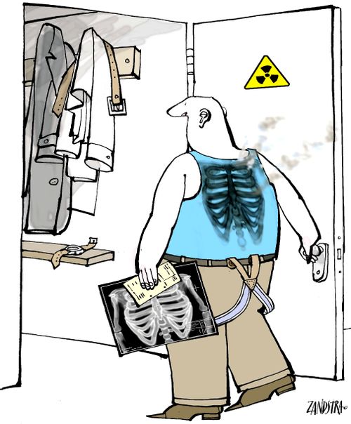 Man with x-ray burnt onto his back.