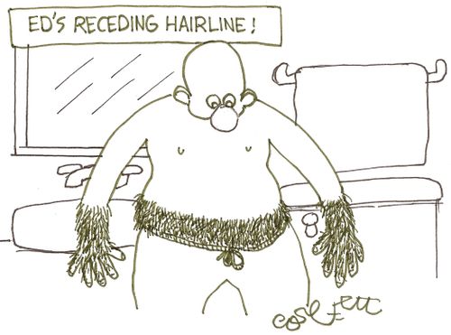 Ed's receding  hairline!