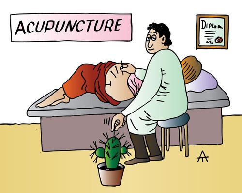 Acupuncture