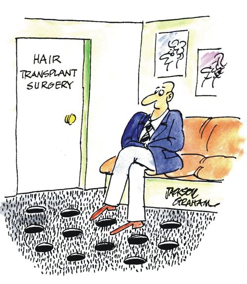 Hair transplant.