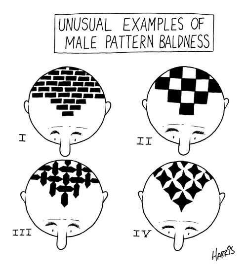Unusual Examples of Male Pattern Baldness