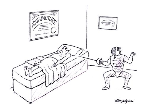 Acupuncture.