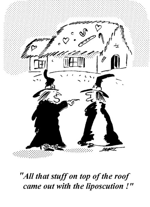 "Allt hat stuff on top of the roof comes out with the liposuction!"