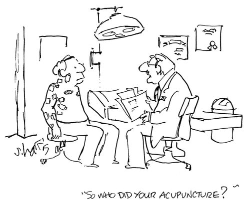 'So who did your acupuncture?'