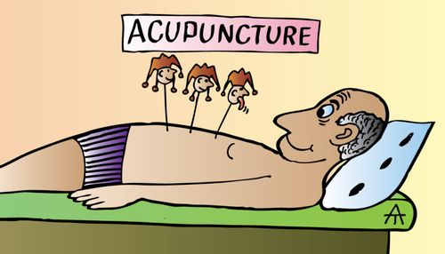 Acupuncture
