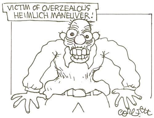 Victim of overzealous Heimlich Maneuver!