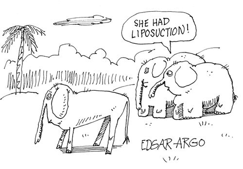 'She's had liposuction.'