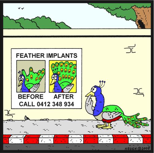 Feather Implants.