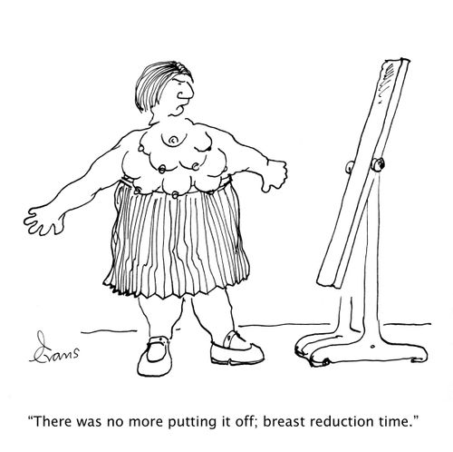'There was no more putting it off; breast reduction time.'