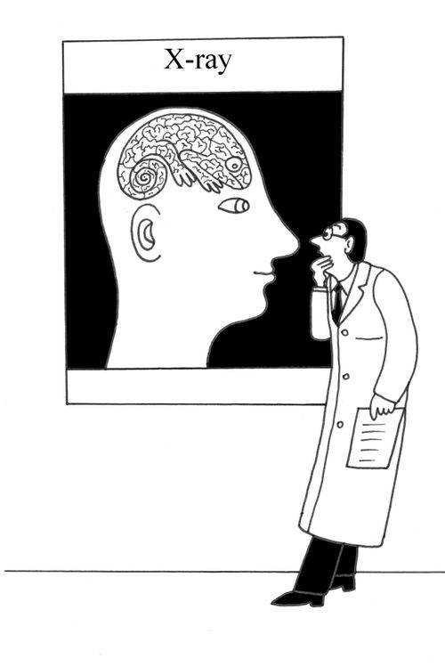 Man with a lizard brain.