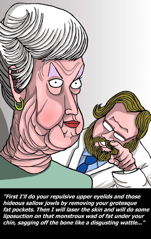 The face lift...
