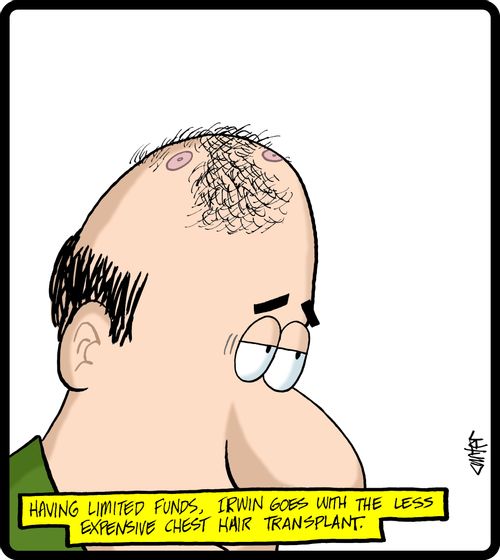 'Having limited funds, Irwin goes with the less expensive chest hair transplant.'