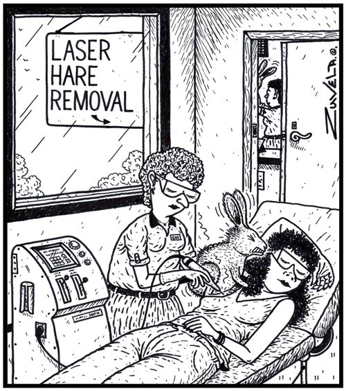 Laser Hare Removal a woman getting laser treatment for the removal of a hare from her armpit
