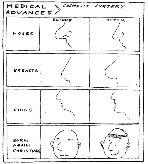 Medical Advances - Cosmentic Surgery - Noses/Breasts/Born Again Christian (lobotomy)