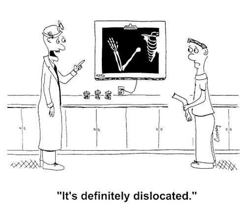"It's definitely dislocated"