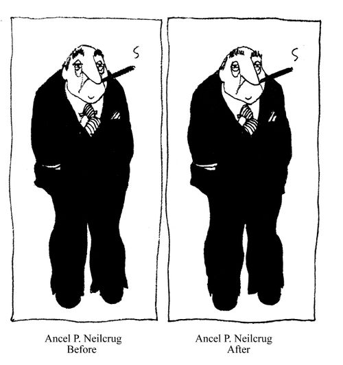 Ancel P.Neilerug Before and After.