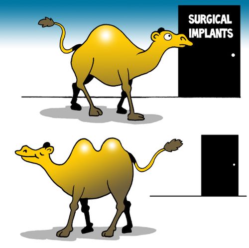 Surgical implants.