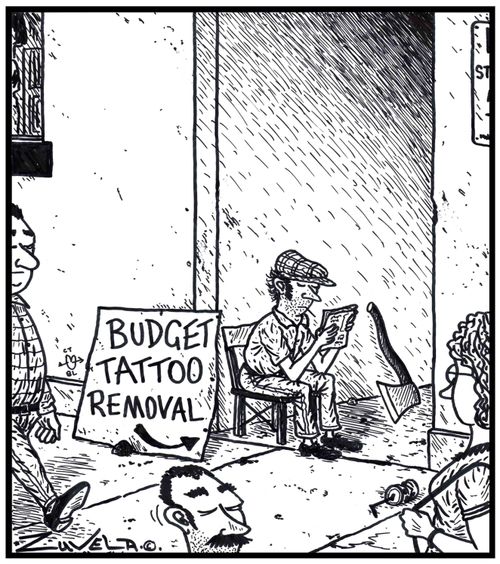 Budget tattoo removal.