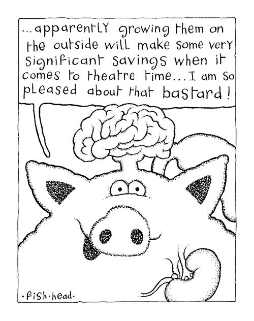 Brain Transplant