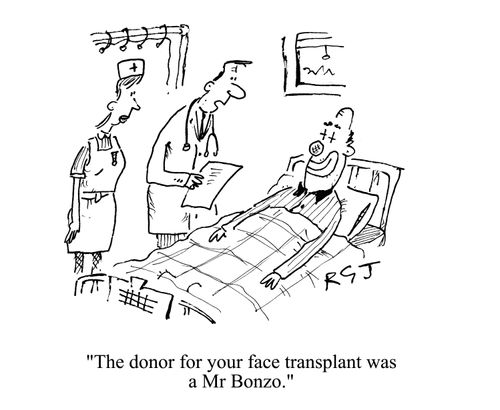'The donor for your face transplant was a Mr. Bonzo.'