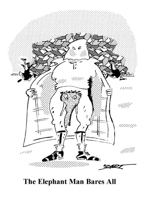 The Elephant Man Bares All.