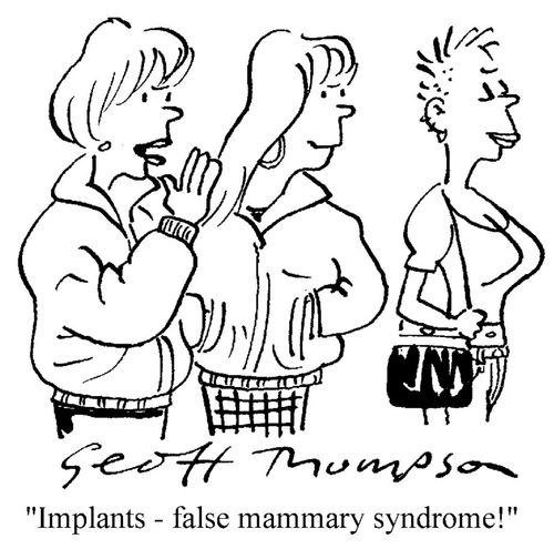 'Implants - false mammary syndrome!'