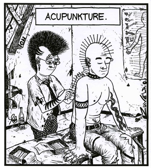 Acupunkture.