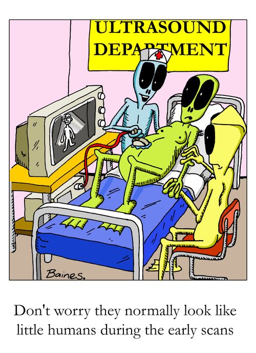 "Don't worry, they normally look like little humans during the early scans."