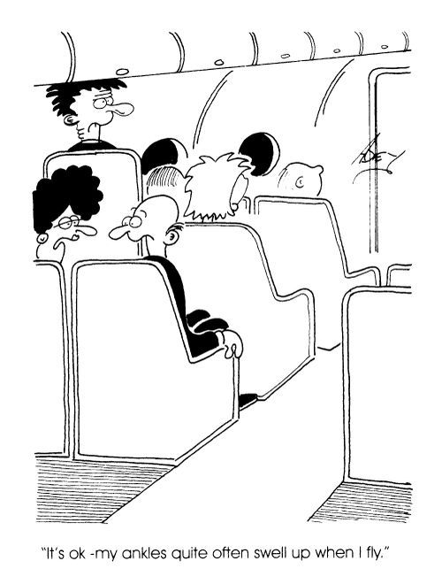 "It's ok, my ankles quite often swell up when I fly"