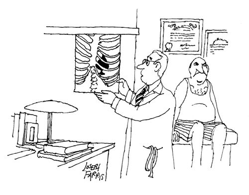 A surprising x-ray.