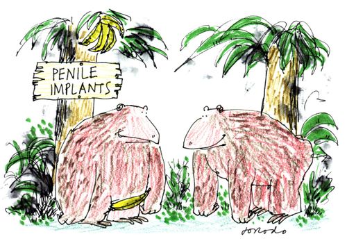 Penile Implants